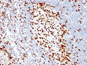 ZAP70 Antibody - Formalin-fixed, paraffin-embedded human tonsil stained with ZAP70 antibody (ZAP70/528).  This image was taken for the unmodified form of this product. Other forms have not been tested.