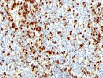 ZAP70 Antibody - IHC testing of FFPE human tonsil with ZAP-70 antibody (clone ZTP70-1).  This image was taken for the unmodified form of this product. Other forms have not been tested.