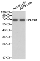 ZAP70 Antibody - Western blot of extracts of various cell lines, using ZAP70 antibody.