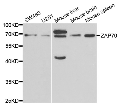 ZAP70 Antibody - Western blot analysis of extracts of various cell lines.