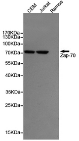 ZAP70 Antibody - Western blot detection of ZAP-70 in CEM and Jurkat cell lysates, negative in the Ramos cell lysates using ZAP-70 mouse monoclonal antibody (1:1000 dilution). Predicted band size: 70KDa. Observed band size:70KDa.