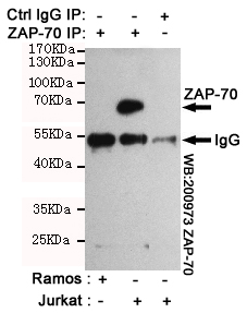 ZAP70 Antibody - Immunoprecipitation analysis of Jurkat cell lysates (ZAP-70 positive expression cell line)and Ramos cell lysates(ZAP-70 negative expression cell line) using ZAP-70 mouse monoclonal antibody.