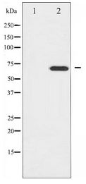 ZAP70 Antibody - Western blot of ZAP-70 expression in Jurkat whole cell lysates,The lane on the left is treated with the antigen-specific peptide.ng Phospho-Akt(Ser473) Antibody.