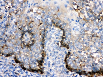 ZAP70 Antibody