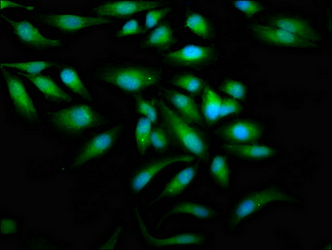 ZAP70 Antibody - Immunofluorescence staining of Hela cells at a dilution of 1:100, counter-stained with DAPI. The cells were fixed in 4% formaldehyde, permeabilized using 0.2% Triton X-100 and blocked in 10% normal Goat Serum. The cells were then incubated with the antibody overnight at 4 °C.The secondary antibody was Alexa Fluor 488-congugated AffiniPure Goat Anti-Rabbit IgG (H+L) .
