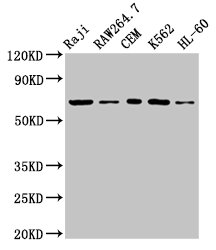 ZAP70 Antibody - Positive Western Blot detected in Raji whole cell lysate, Raw264.7 whole cell lysate, CEM whole cell lysate, K562 whole cell lysate, HL-60 whole cell lysate. All lanes: ZAP70 antibody at 3.2 µg/ml Secondary Goat polyclonal to rabbit IgG at 1/50000 dilution. Predicted band size: 70, 36, 56 KDa. Observed band size: 70 KDa