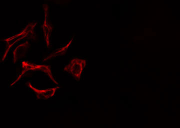 ZAP70 Antibody - Staining HeLa cells by IF/ICC. The samples were fixed with PFA and permeabilized in 0.1% Triton X-100, then blocked in 10% serum for 45 min at 25°C. The primary antibody was diluted at 1:200 and incubated with the sample for 1 hour at 37°C. An Alexa Fluor 594 conjugated goat anti-rabbit IgG (H+L) antibody, diluted at 1/600, was used as secondary antibody.