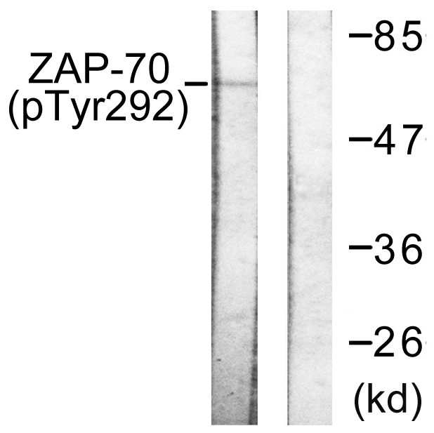 ZAP70 Antibody - Western blot analysis of lysates from Jurkat cells treated with UV 15', using ZAP-70 (Phospho-Tyr292) Antibody. The lane on the right is blocked with the phospho peptide.