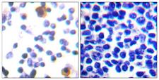 ZAP70 Antibody - Immunohistochemistry analysis of paraffin-embedded human lymph node, using ZAP-70 (Phospho-Tyr315) Antibody. The picture on the right is blocked with the phospho peptide.
