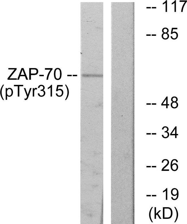 ZAP70 Antibody - Western blot analysis of lysates from Jurkat cells treated with Ca+ 40nM 30', using ZAP-70 (Phospho-Tyr315) Antibody. The lane on the right is blocked with the phospho peptide.