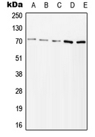 ZAP70 Antibody - Western blot analysis of ZAP70 (pY315) expression in Jurkat H2O2-treated (A); HeLa H2O2-treated (B); Ramos lambda phosphatase-treated (C); mouse kidney (D); rat kidney (E) whole cell lysates.