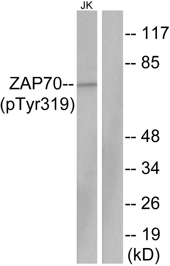 ZAP70 Antibody - Western blot analysis of lysates from Jurkat cells, using ZAP-70 (Phospho-Tyr319) Antibody. The lane on the right is blocked with the phospho peptide.