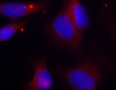ZAP70 Antibody - Immunofluorescence staining of methanol-fixed HeLa cells.