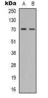 ZAP70 Antibody - Western blot analysis of ZAP70 (pY319) expression in SHSY5Y (A); Jurkat (B) whole cell lysates.