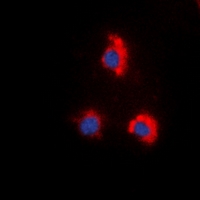 ZAP70 Antibody - Immunofluorescent analysis of ZAP70 (pY319) staining in HeLa cells. Formalin-fixed cells were permeabilized with 0.1% Triton X-100 in TBS for 5-10 minutes and blocked with 3% BSA-PBS for 30 minutes at room temperature. Cells were probed with the primary antibody in 3% BSA-PBS and incubated overnight at 4 deg C in a humidified chamber. Cells were washed with PBST and incubated with a DyLight 594-conjugated secondary antibody (red) in PBS at room temperature in the dark. DAPI was used to stain the cell nuclei (blue).