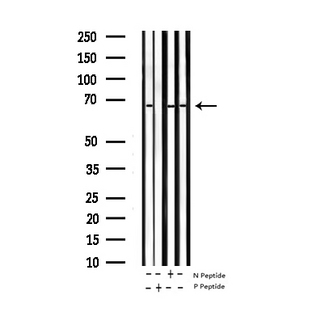 ZAP70 Antibody - Western blot analysis of Phospho-ZAP-70 (Tyr319) expression in various lysates