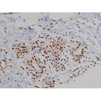 ZAP70 Antibody - 1:200 staining human heart tissue by IHC-P. The tissue was formaldehyde fixed and a heat mediated antigen retrieval step in citrate buffer was performed. The tissue was then blocked and incubated with the antibody for 1.5 hours at 22°C. An HRP conjugated goat anti-rabbit antibody was used as the secondary.