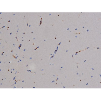 ZAP70 Antibody - 1:200 staining mouse brain tissue by IHC-P. The tissue was formaldehyde fixed and a heat mediated antigen retrieval step in citrate buffer was performed. The tissue was then blocked and incubated with the antibody for 1.5 hours at 22°C. An HRP conjugated goat anti-rabbit antibody was used as the secondary.