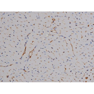 ZAP70 Antibody - 1:200 staining mouse heart tissue by IHC-P. The tissue was formaldehyde fixed and a heat mediated antigen retrieval step in citrate buffer was performed. The tissue was then blocked and incubated with the antibody for 1.5 hours at 22°C. An HRP conjugated goat anti-rabbit antibody was used as the secondary.