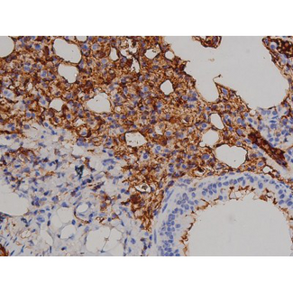 ZAP70 Antibody - 1:200 staining mouse lung1.JPG tissue by IHC-P. The tissue was formaldehyde fixed and a heat mediated antigen retrieval step in citrate buffer was performed. The tissue was then blocked and incubated with the antibody for 1.5 hours at 22°C. An HRP conjugated goat anti-rabbit antibody was used as the secondary.