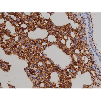 ZAP70 Antibody - 1:200 staining mouse lung2.JPG tissue by IHC-P. The tissue was formaldehyde fixed and a heat mediated antigen retrieval step in citrate buffer was performed. The tissue was then blocked and incubated with the antibody for 1.5 hours at 22°C. An HRP conjugated goat anti-rabbit antibody was used as the secondary.