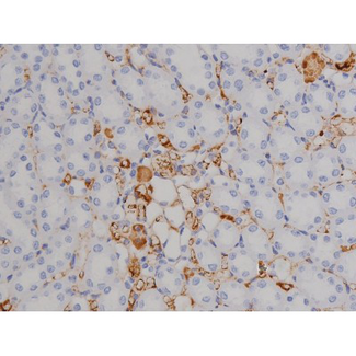 ZAP70 Antibody - 1:200 staining rat kidney tissue by IHC-P. The tissue was formaldehyde fixed and a heat mediated antigen retrieval step in citrate buffer was performed. The tissue was then blocked and incubated with the antibody for 1.5 hours at 22°C. An HRP conjugated goat anti-rabbit antibody was used as the secondary.