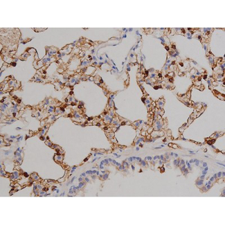 ZAP70 Antibody - 1:200 staining rat lung tissue by IHC-P. The tissue was formaldehyde fixed and a heat mediated antigen retrieval step in citrate buffer was performed. The tissue was then blocked and incubated with the antibody for 1.5 hours at 22°C. An HRP conjugated goat anti-rabbit antibody was used as the secondary.