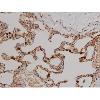 ZAP70 Antibody - 1:200 staining rat lung tissue by IHC-P. The tissue was formaldehyde fixed and a heat mediated antigen retrieval step in citrate buffer was performed. The tissue was then blocked and incubated with the antibody for 1.5 hours at 22°C. An HRP conjugated goat anti-rabbit antibody was used as the secondary.