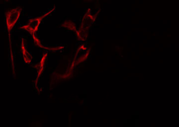 ZAP70 Antibody - Staining HeLa cells by IF/ICC. The samples were fixed with PFA and permeabilized in 0.1% Triton X-100, then blocked in 10% serum for 45 min at 25°C. The primary antibody was diluted at 1:200 and incubated with the sample for 1 hour at 37°C. An Alexa Fluor 594 conjugated goat anti-rabbit IgG (H+L) antibody, diluted at 1/600, was used as secondary antibody.