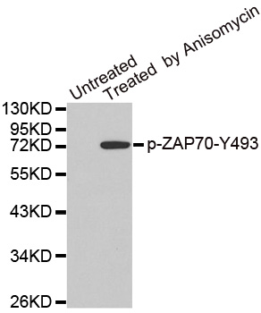 ZAP70 Antibody - Western blot analysis of extracts from JK cells.