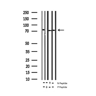 ZAP70 Antibody - Western blot analysis of Phospho-ZAP-70 (Tyr493) expression in various lysates