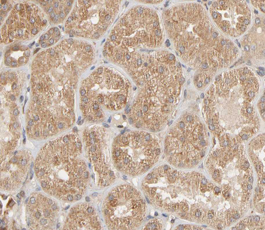 ZAP70 Antibody - 1:200 staining human kidney tissue by IHC-P. The tissue was formaldehyde fixed and a heat mediated antigen retrieval step in citrate buffer was performed. The tissue was then blocked and incubated with the antibody for 1.5 hours at 22° C. An HRP conjugated goat anti-rabbit antibody was used as the secondary.