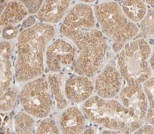 ZAP70 Antibody - 1:200 staining human kidney tissue by IHC-P. The tissue was formaldehyde fixed and a heat mediated antigen retrieval step in citrate buffer was performed. The tissue was then blocked and incubated with the antibody for 1.5 hours at 22° C. An HRP conjugated goat anti-rabbit antibody was used as the secondary.