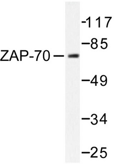 ZAP70 Antibody - Western blot of ZAP-70 (T286) pAb in extracts from 293 cells treated with PMA 125ng/ml 30'.