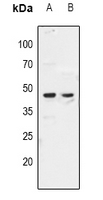 ZAR1 Antibody - Western blot analysis of ZAR1 expression in mouse testis (A), rat testis (B) whole cell lysates.