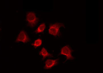 ZAR1 Antibody - Staining 293 cells by IF/ICC. The samples were fixed with PFA and permeabilized in 0.1% Triton X-100, then blocked in 10% serum for 45 min at 25°C. The primary antibody was diluted at 1:200 and incubated with the sample for 1 hour at 37°C. An Alexa Fluor 594 conjugated goat anti-rabbit IgG (H+L) Ab, diluted at 1/600, was used as the secondary antibody.