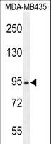 ZBBX Antibody - ZBBX Antibody western blot of MDA-MB435 cell line lysates (35 ug/lane). The ZBBX antibody detected the ZBBX protein (arrow).