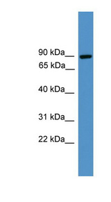 ZBED1 / TRAMP Antibody - ZBED1 antibody Western blot of Jurkat lysate. This image was taken for the unconjugated form of this product. Other forms have not been tested.