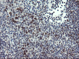 ZBED1 / TRAMP Antibody - IHC of paraffin-embedded Human tonsil using anti-ZBED1 mouse monoclonal antibody.