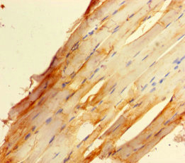 ZBED1 / TRAMP Antibody - Immunohistochemistry of paraffin-embedded human skeletal muscle tissue using ZBED1 Antibody at dilution of 1:100