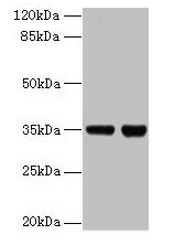 ZBED1 / TRAMP Antibody - Western blot All lanes: Zinc finger BED domain-containing protein 1 antibody at 2µg/ml Lane 1: EC109 whole cell lysate Lane 2: 293T whole cell lysate Secondary Goat polyclonal to rabbit IgG at 1/15000 dilution Predicted band size: 76 kDa Observed band size: 35 kDa