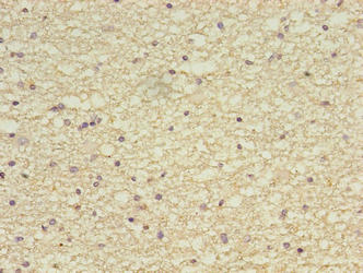 ZBED6CL / C7orf29 Antibody - Immunohistochemistry of paraffin-embedded human brain tissue using ZBED6CL Antibody at dilution of 1:100