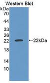 ZBED9 / SCAND3 Antibody - Western blot of ZBED9 / SCAND3 antibody.
