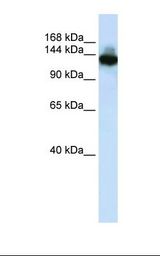 ZBED9 / SCAND3 Antibody - HepG2 cell lysate. Antibody concentration: 1.0 ug/ml. Gel concentration: 6-18%.  This image was taken for the unconjugated form of this product. Other forms have not been tested.