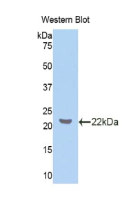 ZBP1 Antibody - Western blot of recombinant ZBP1.  This image was taken for the unconjugated form of this product. Other forms have not been tested.