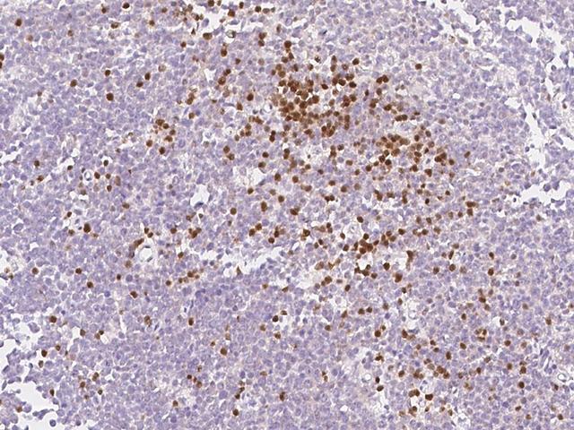 ZBP1 Antibody - Immunochemical staining of human ZBP1 in human tonsil with rabbit polyclonal antibody at 1:200 dilution, formalin-fixed paraffin embedded sections.