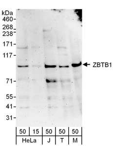 ZBTB1 Antibody - Detection of Human and Mouse ZBTB1 by Western Blot. Samples: Whole cell lysate from HeLa (15 and 50 ug), Jurkat (J; 50 ug), 293T (T; 50 ug) and mouse NIH3T3 (M; 50 ug) cells. Antibodies: Affinity purified rabbit anti-ZBTB1 antibody used for WB at 0.4 ug/ml. Detection: Chemiluminescence with an exposure time of 3 minutes.