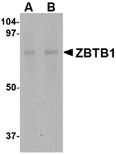 ZBTB1 Antibody - Western blot of ZBTB1 in mouse brain tissue lysate with ZBTB1 antibody at (A) 1 and (B) 2 ug/ml