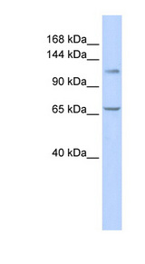 ZBTB10 Antibody - ZBTB10 antibody Western blot of 721_B cell lysate. This image was taken for the unconjugated form of this product. Other forms have not been tested.