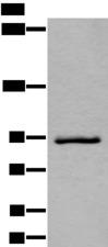 ZBTB10 Antibody - Western blot analysis of Jurkat cell lysate  using ZBTB10 Polyclonal Antibody at dilution of 1:800